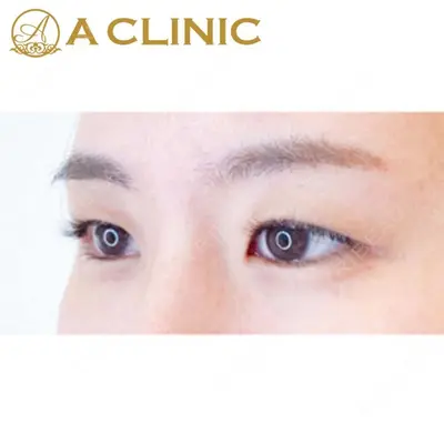 A CLINIC（エークリニック） 池袋院 片桐 大佑医師の症例