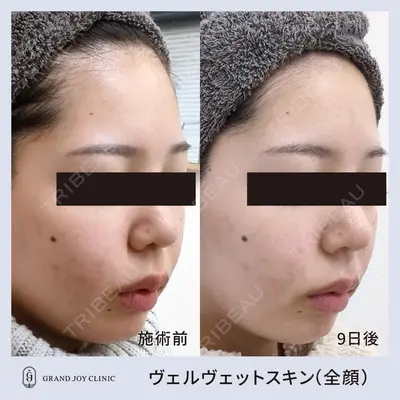 グランジョイクリニック 道上 育子医師の症例