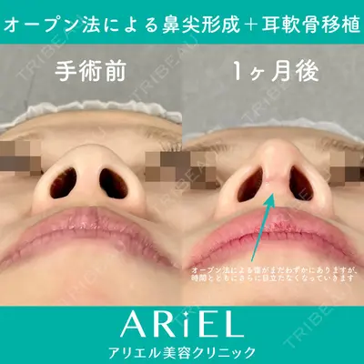 アリエル美容クリニック 大宮院 鈴木　桂介医師の症例