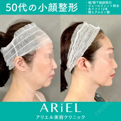 アリエル美容クリニック 大宮院 鈴木　桂介医師の症例
