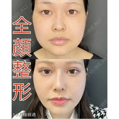 ルラ美容クリニック 渋谷本院 武内 大医師の症例