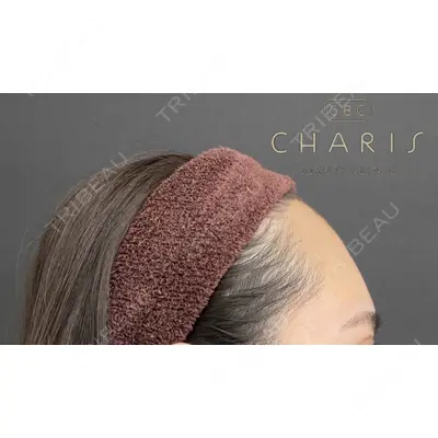 CHARIS BEAUTY CLINICの症例