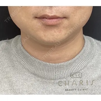 CHARIS BEAUTY CLINICの症例