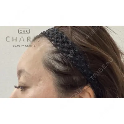 CHARIS BEAUTY CLINICの症例