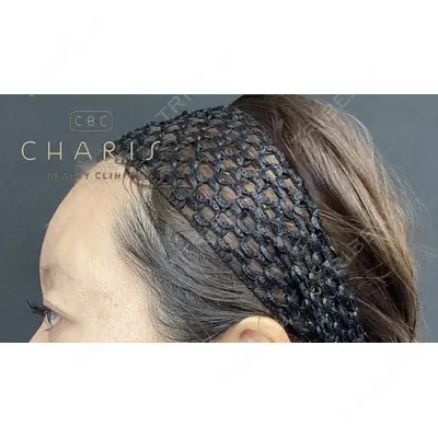 CHARIS BEAUTY CLINICの症例