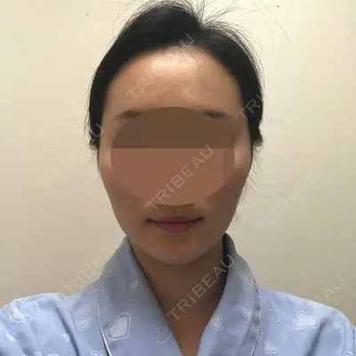 TL美容整形外科 顔面輪郭・目・鼻センター キム・ジミョン医師の症例