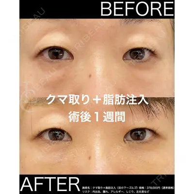 LIBER CLINIC 矢橋 洋一郎医師の症例