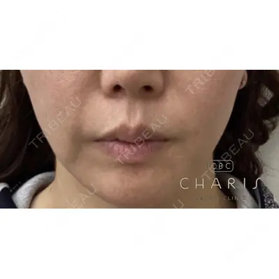 CHARIS BEAUTY CLINICの症例