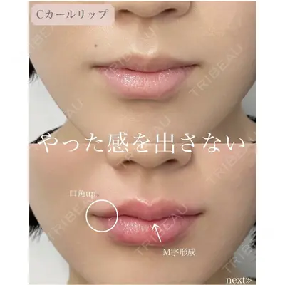 ルラ美容クリニック 渋谷本院の症例