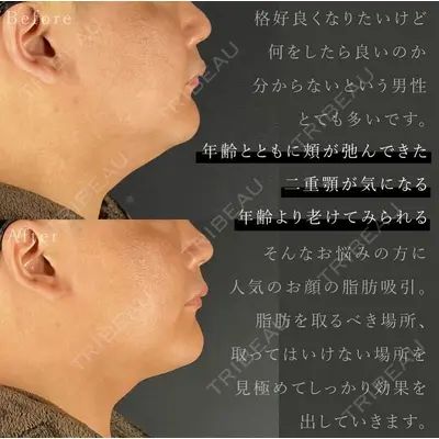 MYCLI【マイクリ】東京・恵比寿院 本田マイケル武史医師の症例