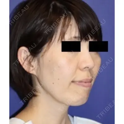 しらゆりメディカルクリニック （旧しらゆりビューティークリニック） 伊藤　孝明医師の症例