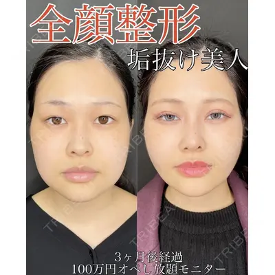 ルラ美容クリニック 渋谷本院 武内 大医師の症例