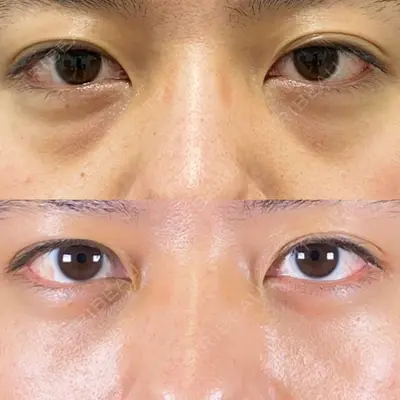 TCB東京中央美容外科 徳島院の症例