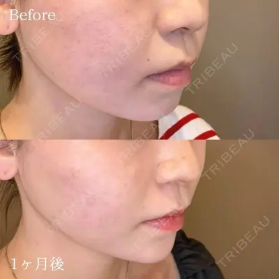 TCB東京中央美容外科 越谷院の症例