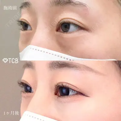 TCB東京中央美容外科 浜松院の症例