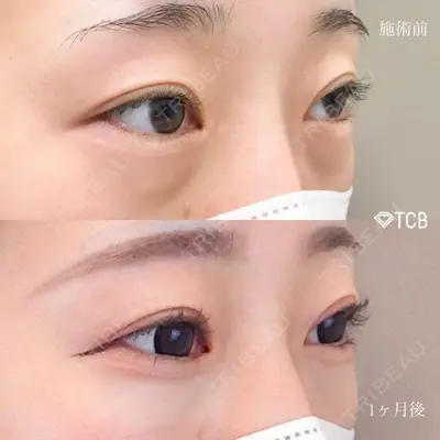 TCB東京中央美容外科 浜松院の症例