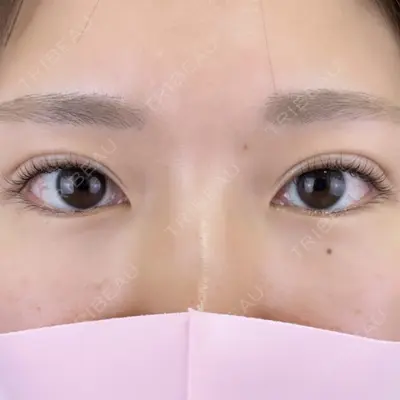 TCB東京中央美容外科 前橋院の症例