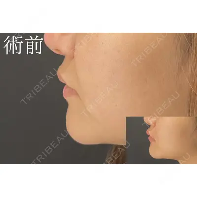 HAAB×DREAM BEAUTY CLINIC 大阪梅田院 柏木 太雅医師の症例