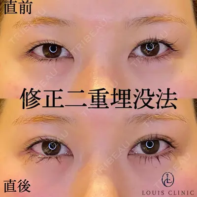 LOUIS CLINIC 二子玉川院【ルイクリニック】 小松 塁医師の症例