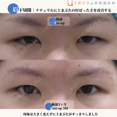 宇都宮ひふ科形成外科の症例