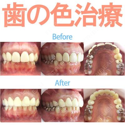 ザ・ホワイトデンタルクリニック 品川院の症例