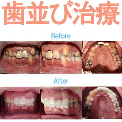 ザ・ホワイトデンタルクリニック 品川院の症例
