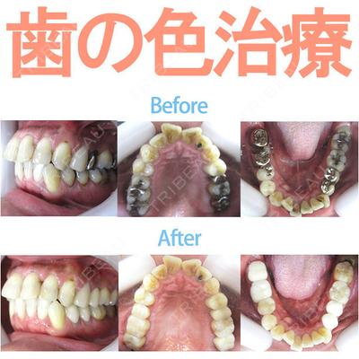 ザ・ホワイトデンタルクリニック 品川院の症例