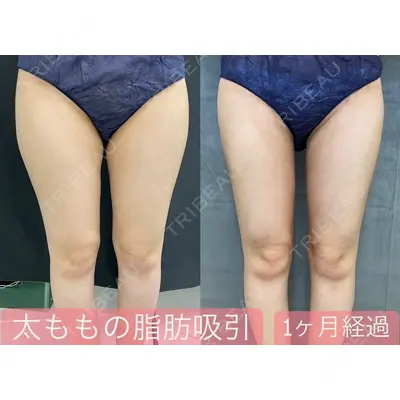 ルラ美容クリニック 新宿院 高木 欽之医師の症例