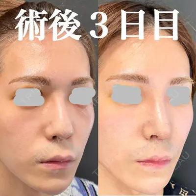 ルラ美容クリニック 新潟院の症例