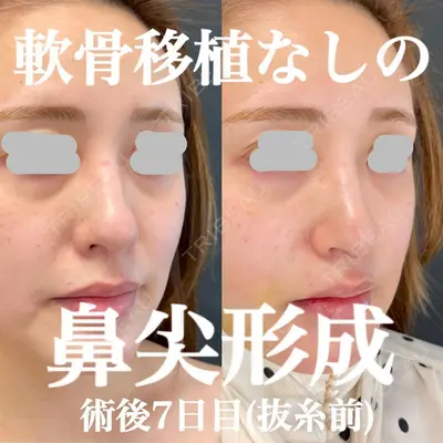 ルラ美容クリニック 神戸院の症例