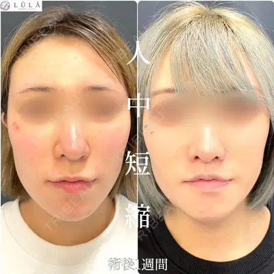 ルラ美容クリニック 大阪心斎橋院 藤川 一朗医師の症例