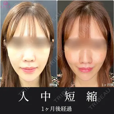 ルラ美容クリニック 大阪心斎橋院 藤川 一朗医師の症例