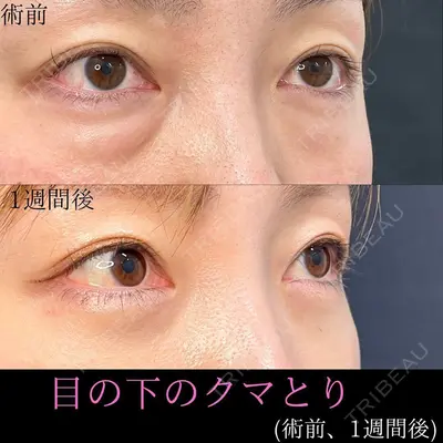 ルラ美容クリニック 高田馬場院の症例