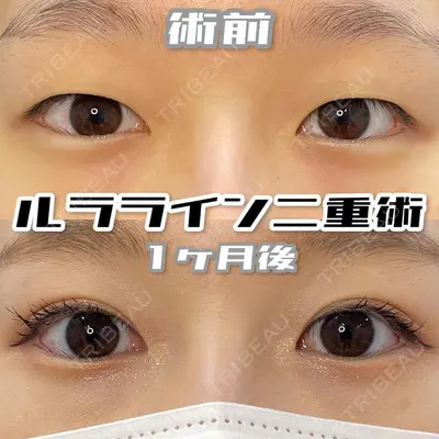 ルラ美容クリニック 池袋院 小海 元｜長期休暇につき指名不可医師の症例