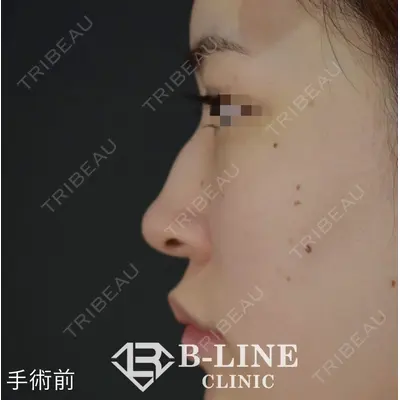 B-LINE CLINIC 池袋院 小池 康弘医師の症例