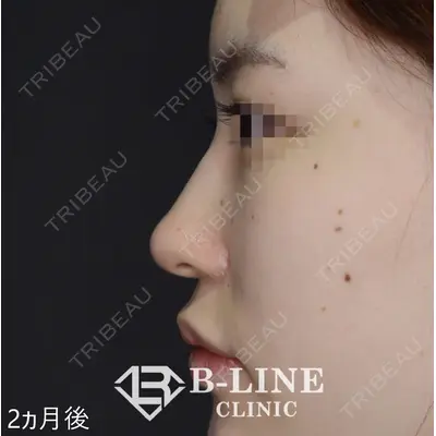 B-LINE CLINIC 池袋院 小池 康弘医師の症例