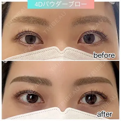 椿クリニック 心斎橋院の症例