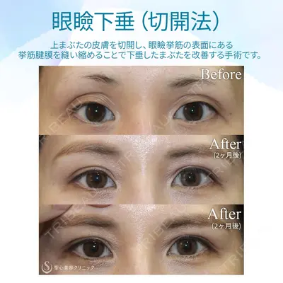 聖心美容クリニック 銀座院 牧野 陽二郎医師の症例