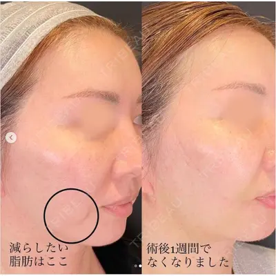 SOL CLINIC 向井 英子医師の症例
