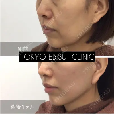 東京エビスクリニックの症例