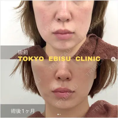 東京エビスクリニックの症例