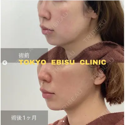 東京エビスクリニックの症例
