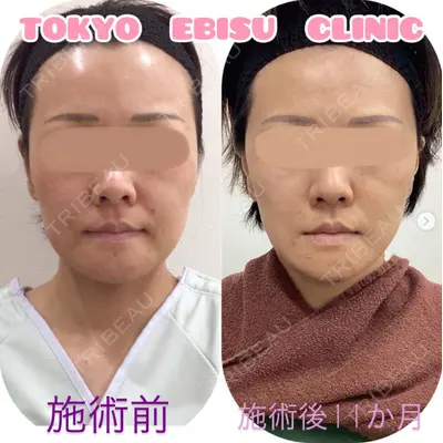 東京エビスクリニックの症例