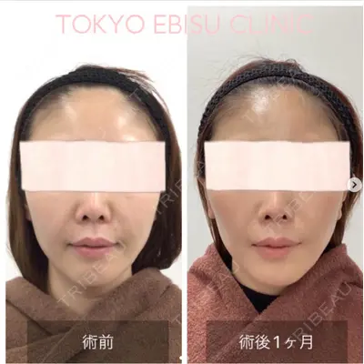 東京エビスクリニックの症例