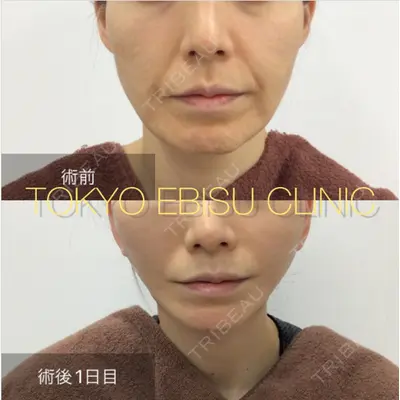 東京エビスクリニックの症例