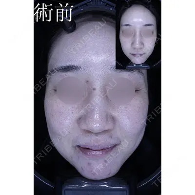 HAAB CLINIC 池袋院の症例