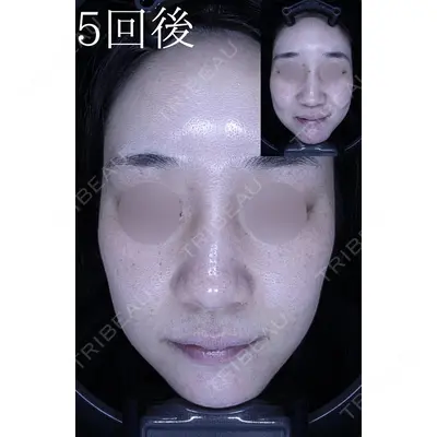 HAAB CLINIC 池袋院の症例