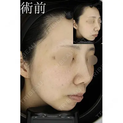HAAB CLINIC 池袋院の症例
