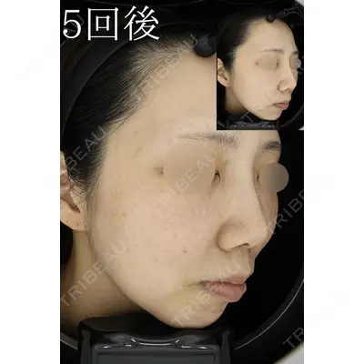 HAAB CLINIC 池袋院の症例