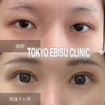 東京エビスクリニックの症例